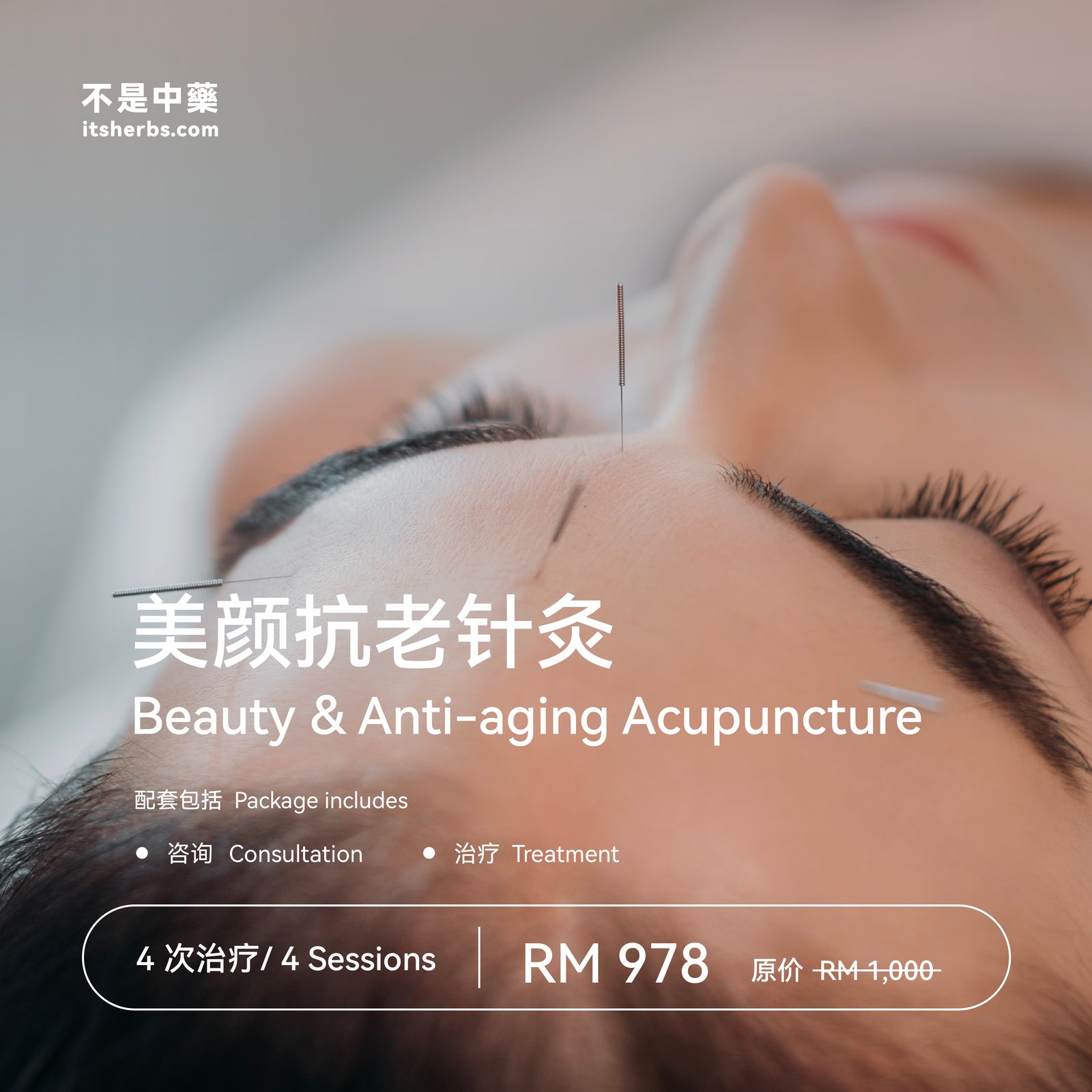 美颜抗老针灸配套